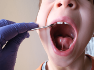 cirurgia oral